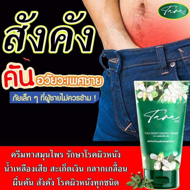 ทารา ครีมทาสังคัง ยาทาแก้สังคัง ยี่ห้อไหนดี